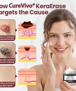 CureVivo® KeraErase Dual-Action Renewal Cream