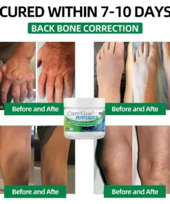 CureVivo® Powerful pain relief&recovery gel