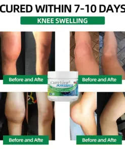 CureVivo® Powerful pain relief&recovery gel