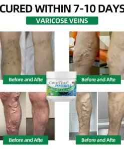 CureVivo® Powerful pain relief&recovery gel