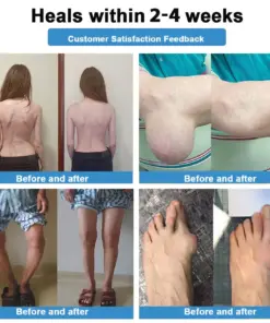 CureVivo® Pain Relief Repair LotionFor Muscle, Joint Nerve Pain