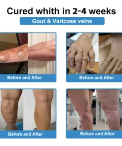 CureVivo® Pain Relief Repair LotionFor Muscle, Joint Nerve Pain