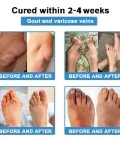 CureVivo® Pain Relief Repair LotionFor Muscle, Joint Nerve Pain