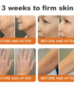 CureVivo® Botox Bee Venom Firming Cream