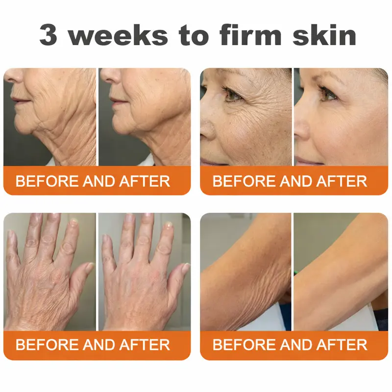 CureVivo® Botox Bee Venom Firming Cream