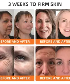 CureVivo® Botox Bee Venom Firming Cream