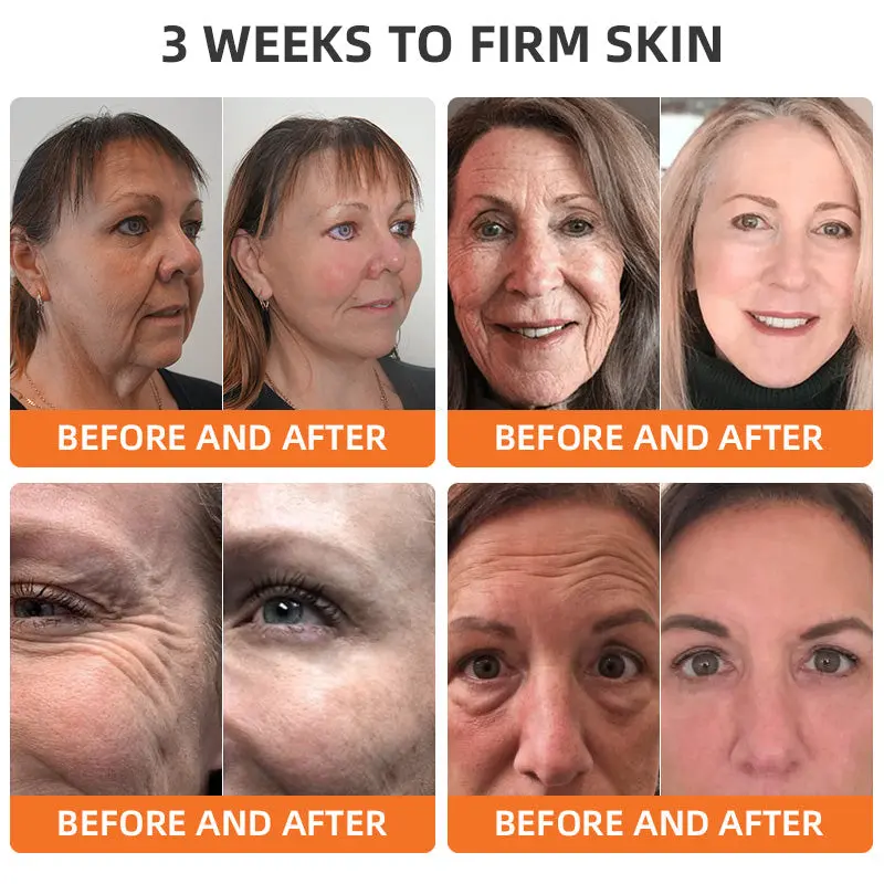 CureVivo® Botox Bee Venom Firming Cream