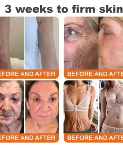 CureVivo® Botox Bee Venom Firming Cream