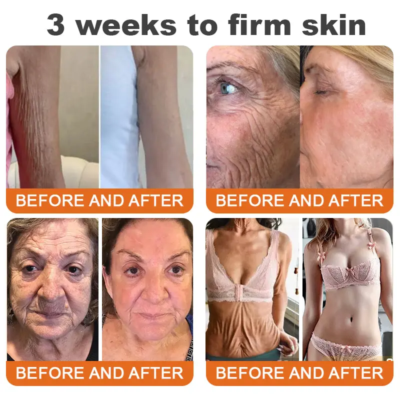 CureVivo® Botox Bee Venom Firming Cream