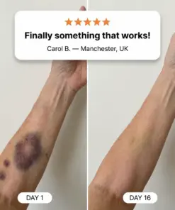 CureVivo® Bruise Repair & Skin Strengthening Cream
