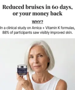 CureVivo® Bruise Repair & Skin Strengthening Cream