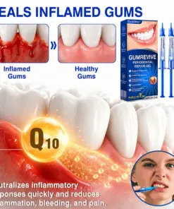 CureVivo® GumRevive Periodontal Repair Gel