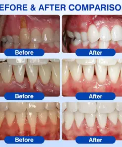 CureVivo® GumRevive Periodontal Repair Gel