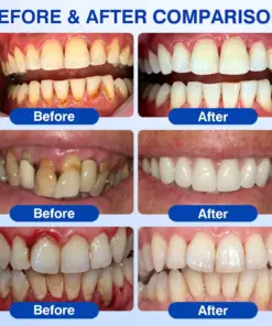 CureVivo® GumRevive Periodontal Repair Gel