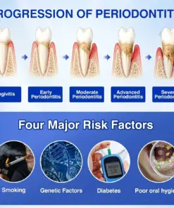 CureVivo® GumRevive Periodontal Repair Gel