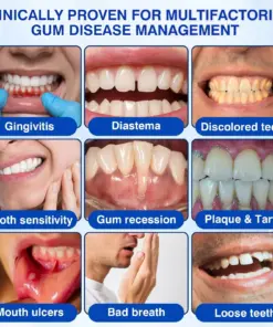 CureVivo® GumRevive Periodontal Repair Gel