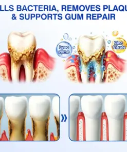 CureVivo® GumRevive Periodontal Repair Gel