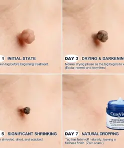 CureVivo® Skin Tag & Spot Eraser Cream