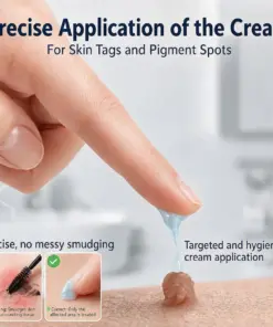 CureVivo® Skin Tag & Spot Eraser Cream
